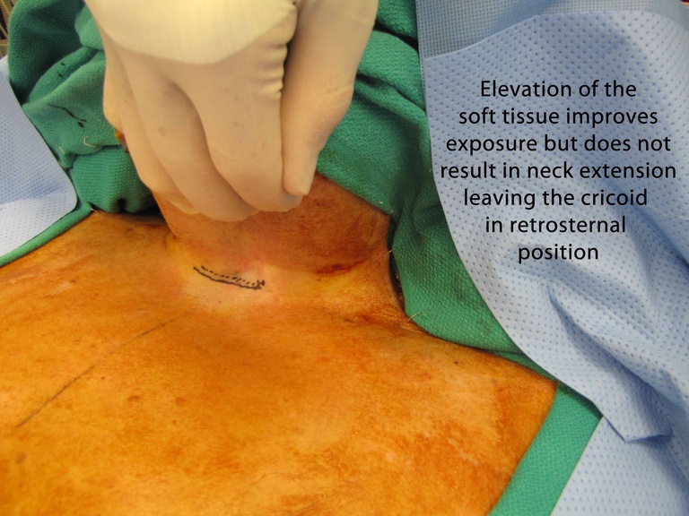 036%20intraop.jpg