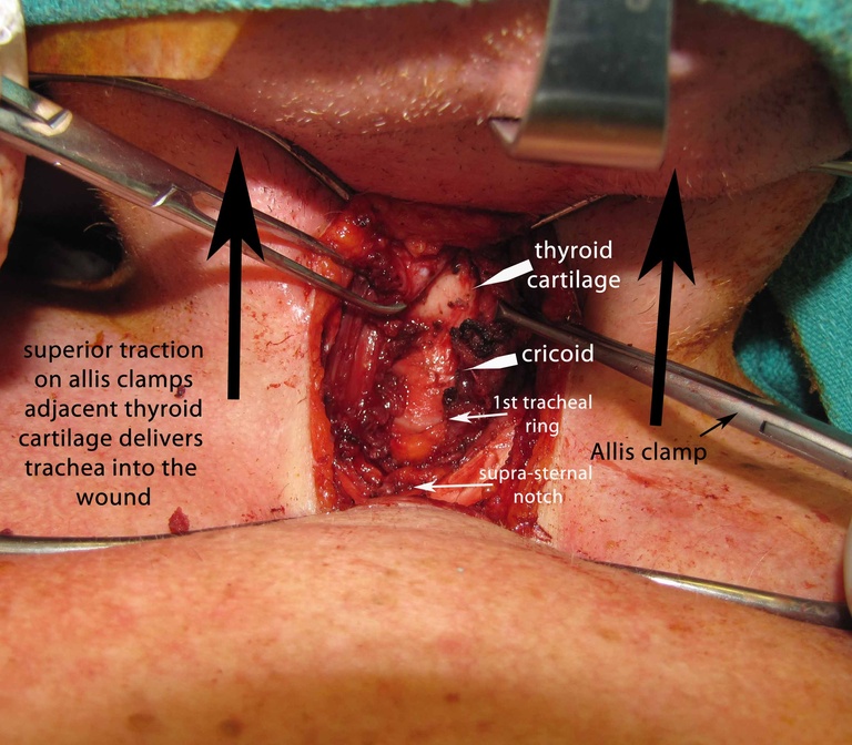 037%20intraop.jpg