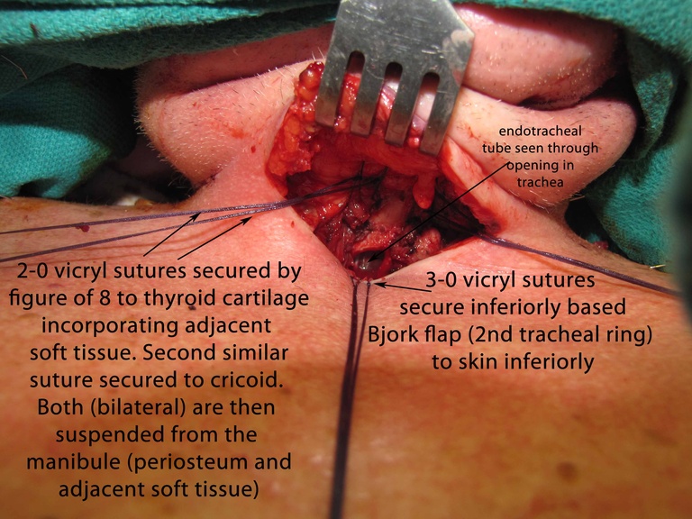 038%20intraop.jpg