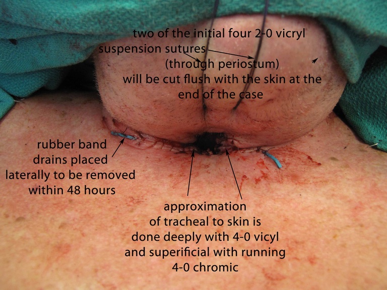 040%20intraop.jpg