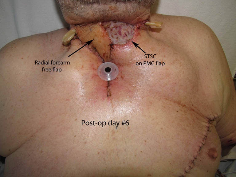 040%20medtrach.jpg