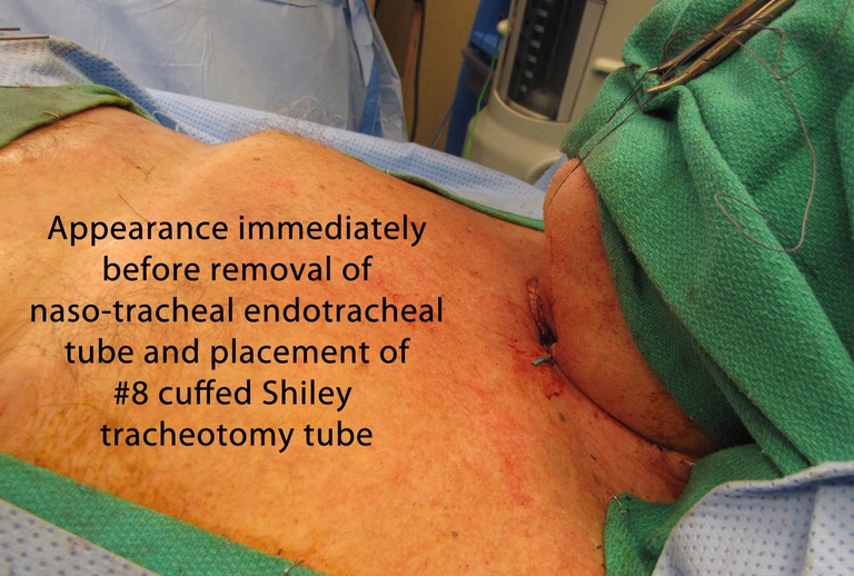 041%20intraop.jpg
