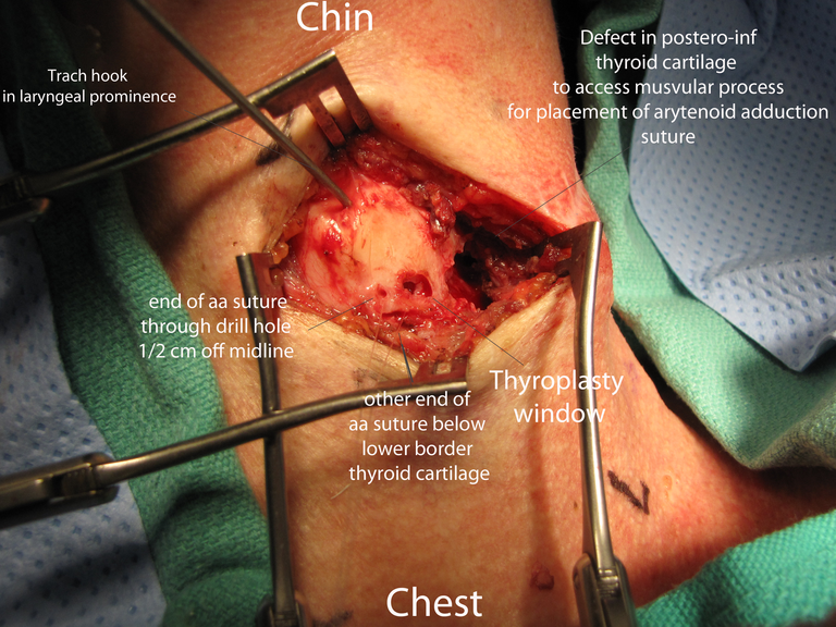 04windows and sutures image.png