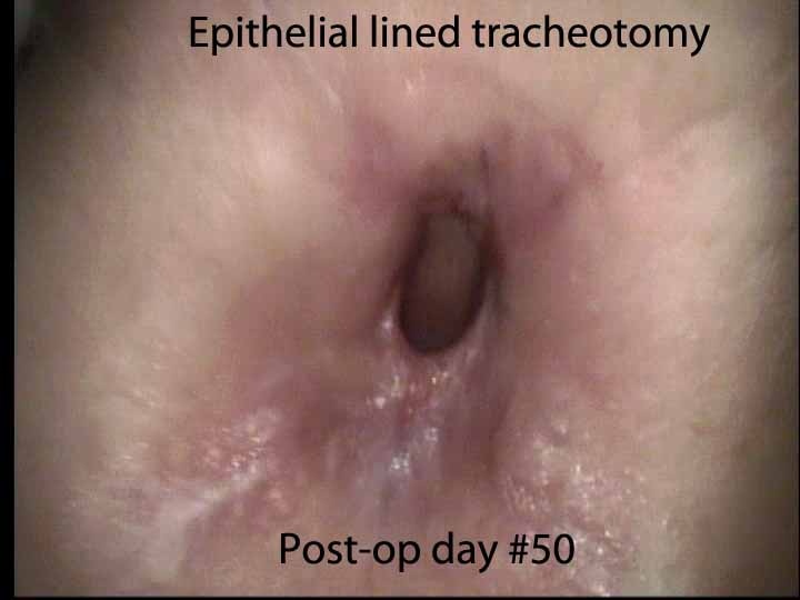 051%20epitracha.jpg