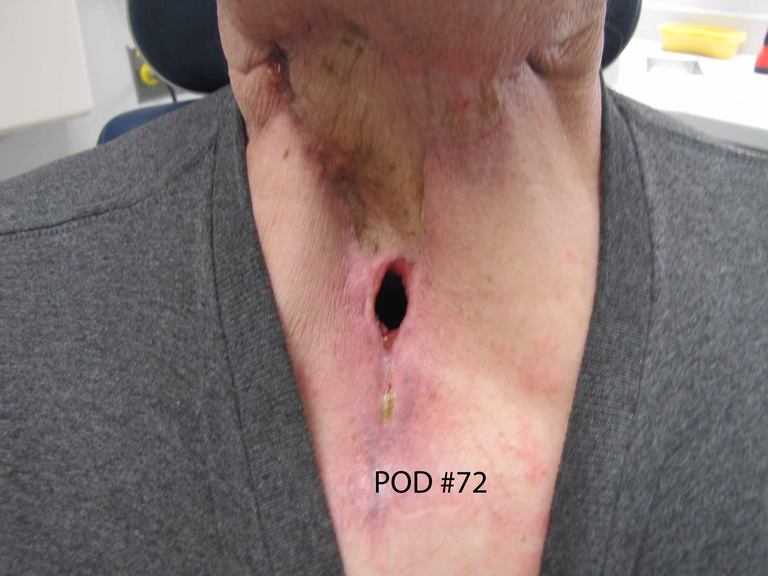 060%20med%20trac%20pod%2072.jpg