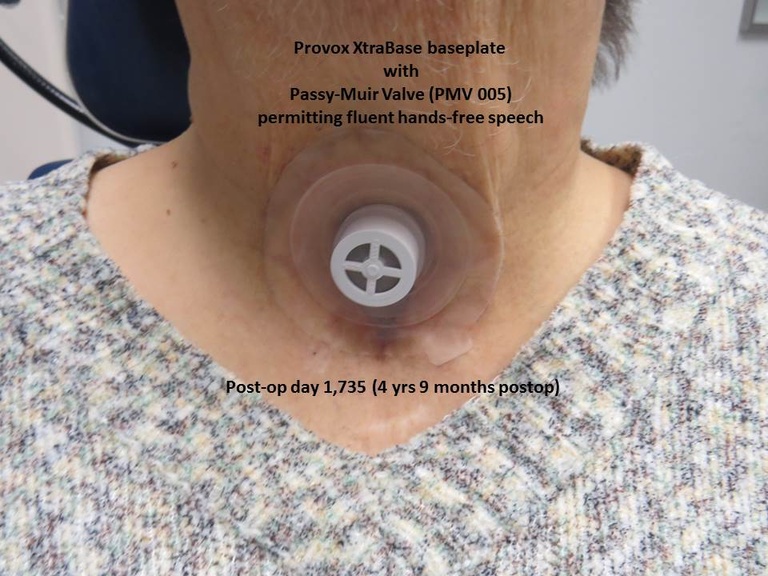 061%20epi%20trach%20a.JPG