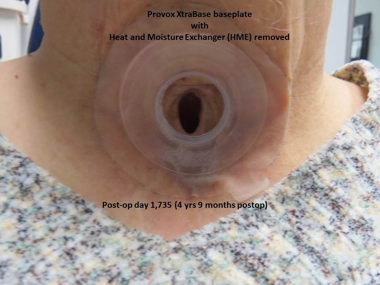 062%20epi%20trach.JPG