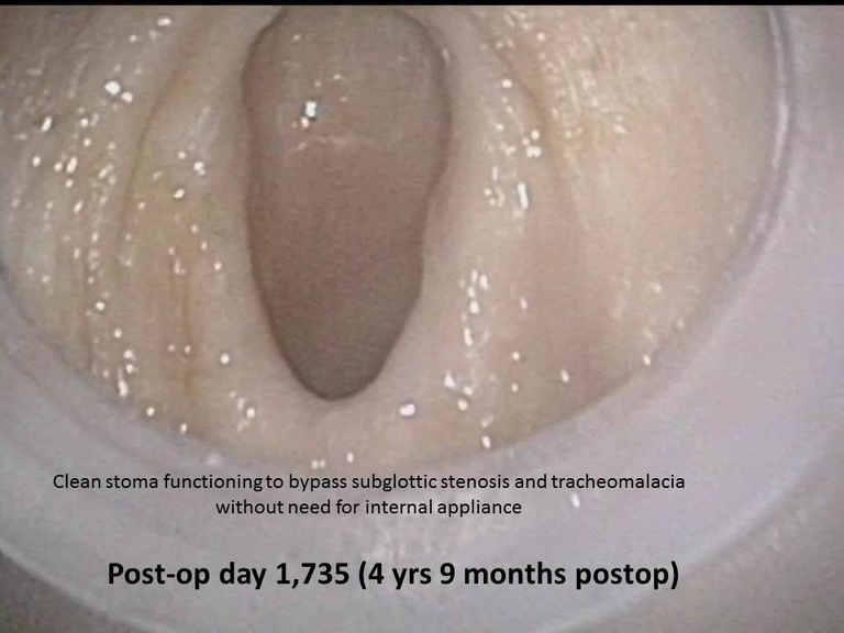066%20epi%20trach%20a.JPG