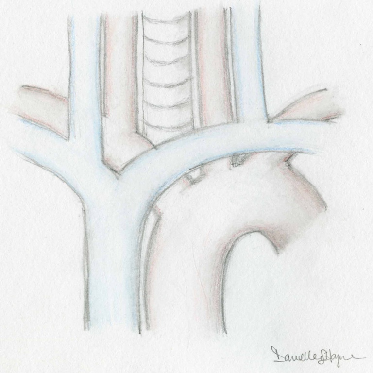 090%20Aorta-Esoph%20low%20res.jpg