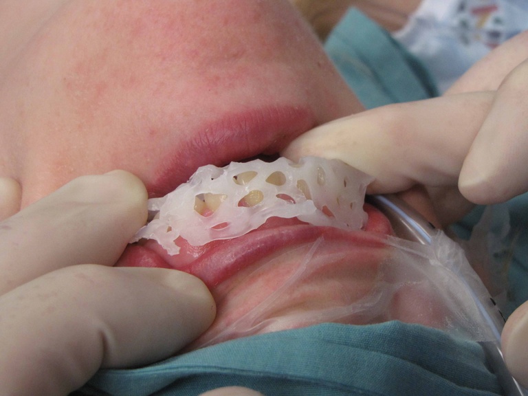 107 dental guard.jpg