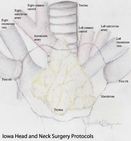 300%20mediastinal%20anatomy.jpg