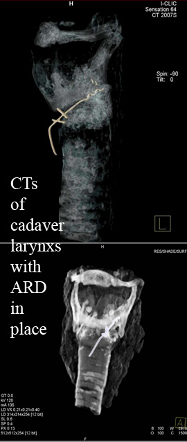 ARD03.jpg