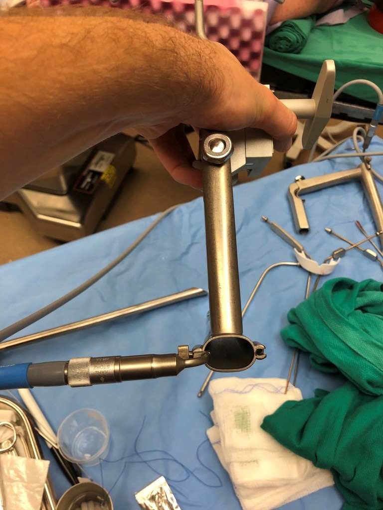 Benjamin Diverticuloscope