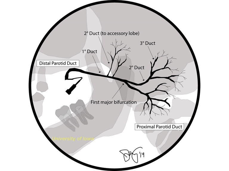 Classification of Salivary Ducts (Image from Iowa Head and Neck Protocols)