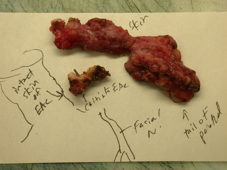 Diagram of Surgical Anatomy