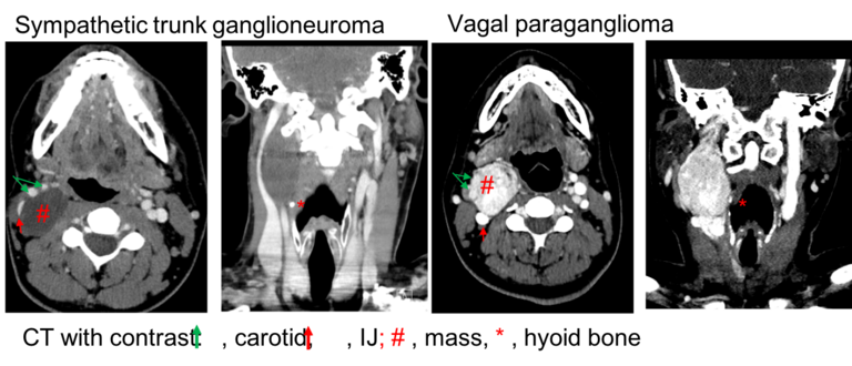 CT with contrast