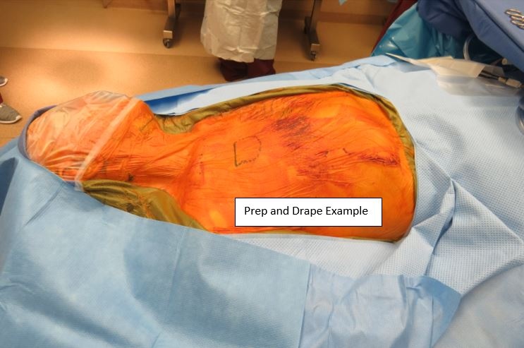 Figure 5. Preparation and drape example