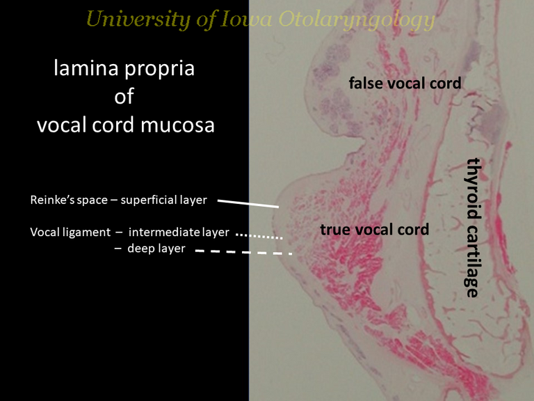 Lamina propria from cadaveric larynx.png