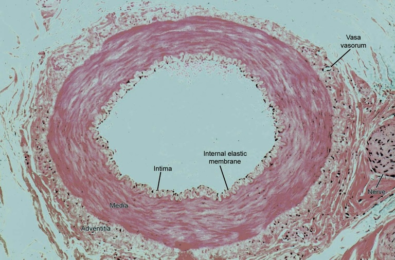 Normal Artery