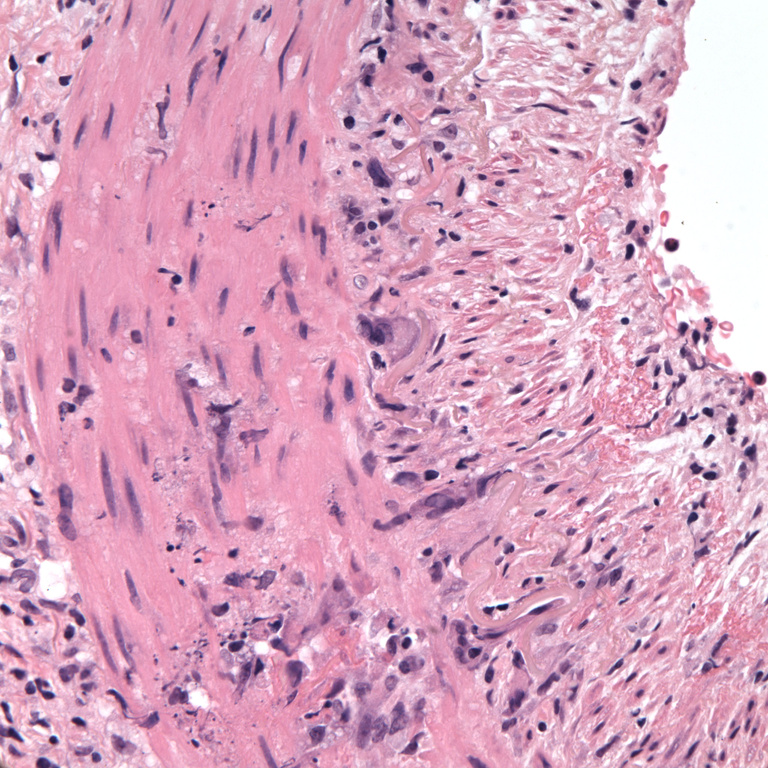 O12-462_GCA_200X.jpg