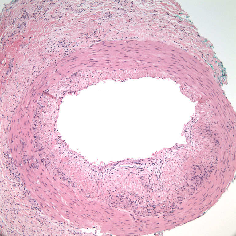    Patient Biopsy 50x                                       