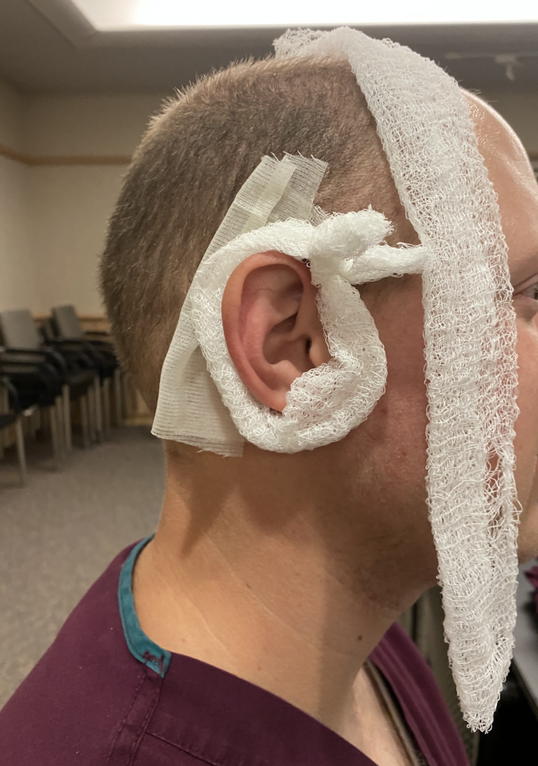 Mastoid Dressing Apply