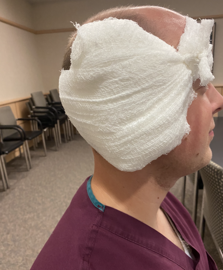 Mastoid Dressing Apply