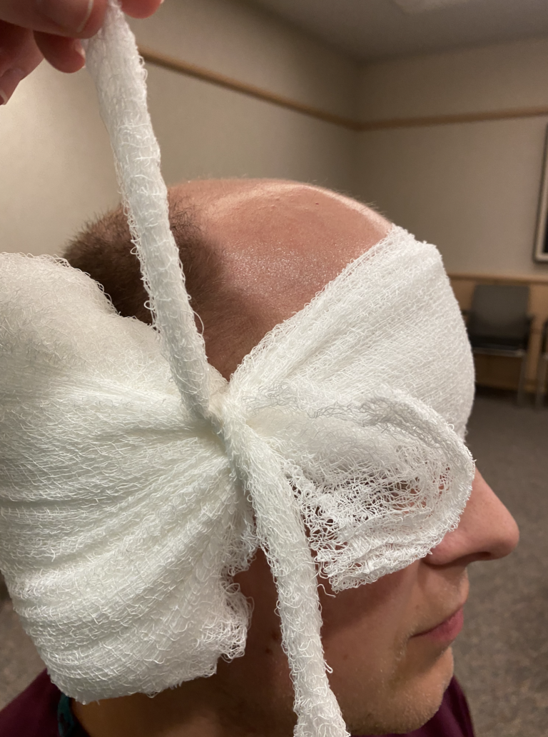 Mastoid Dressing Apply