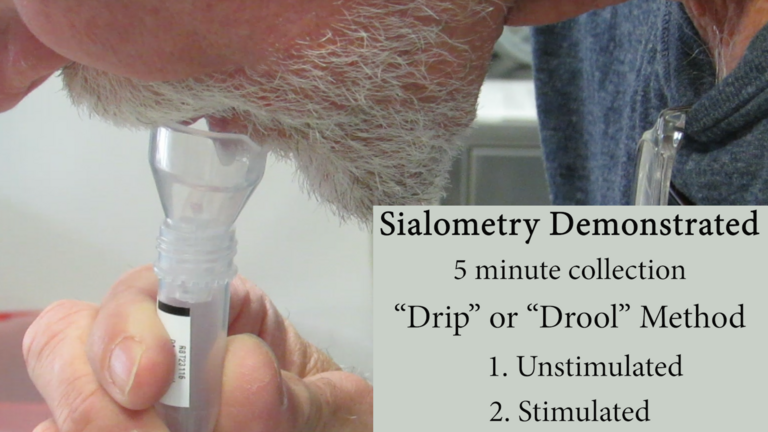 sialometry drip method