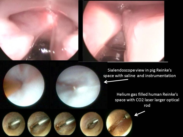 Slide015_0.JPG