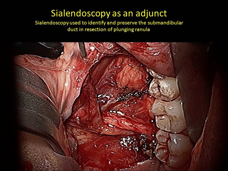Slide017_0.JPG