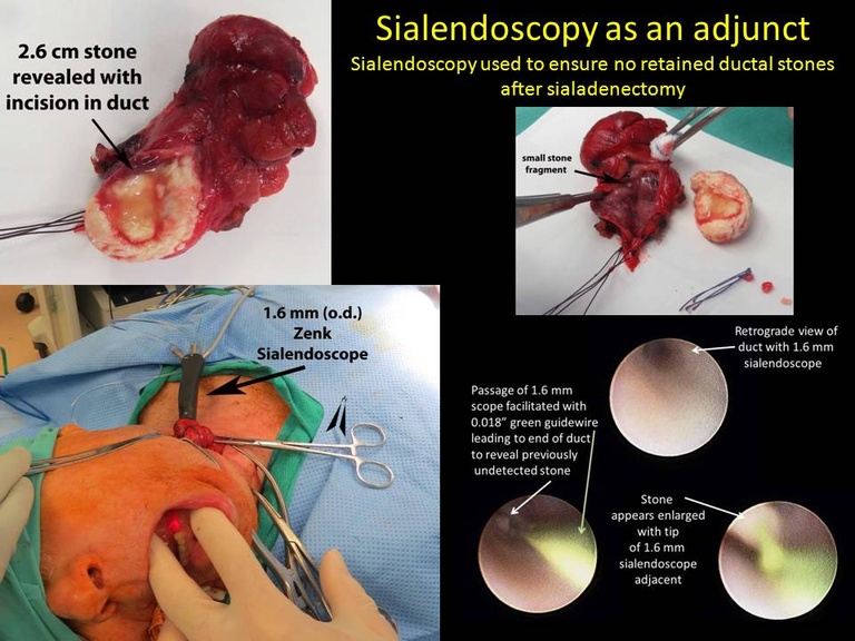 Slide018_0.JPG