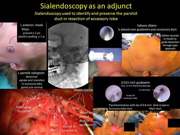 Slide019_0.JPG