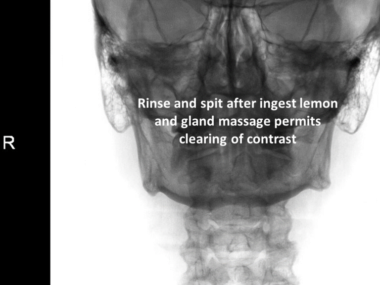 Slide10_24.PNG