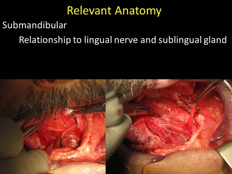 Slide10_3.JPG