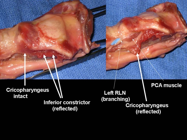 Slide11_0.JPG