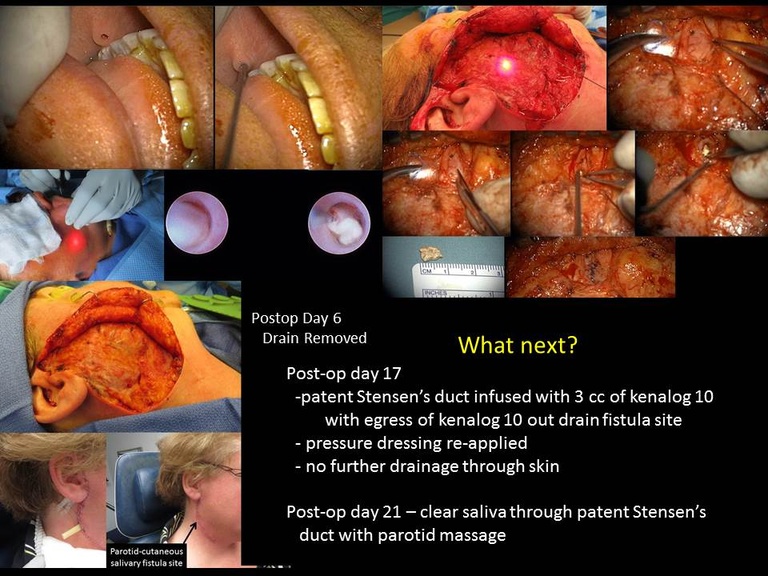 Slide11_3.JPG