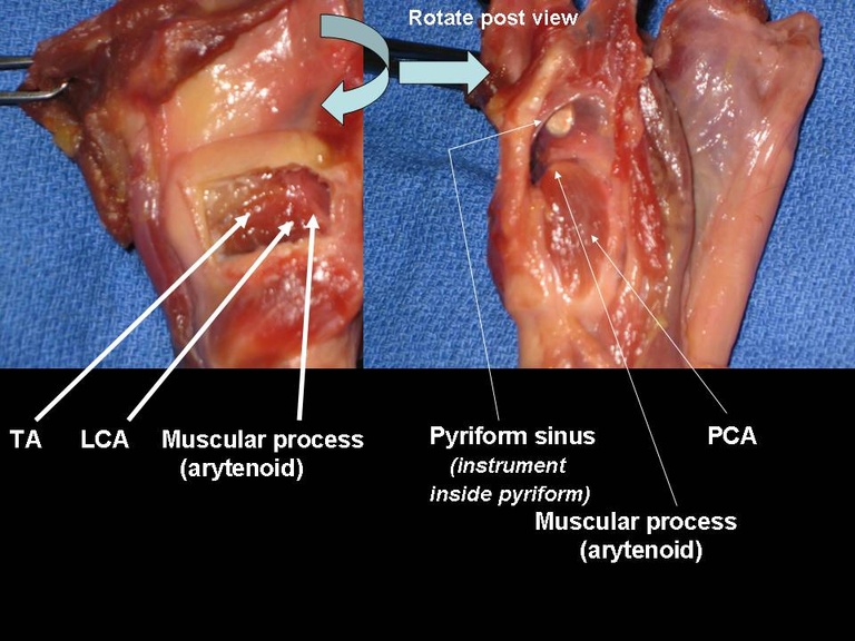 Slide14.JPG