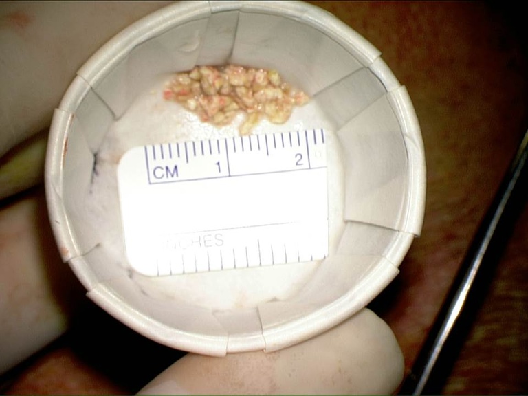 Slide14_4.JPG
