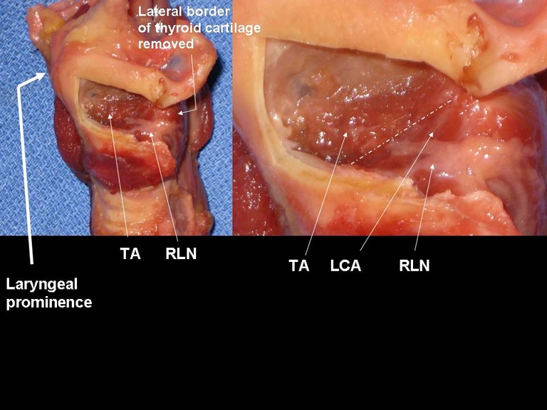Slide16.JPG