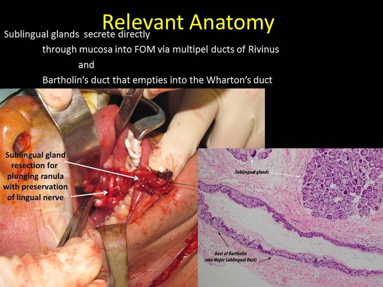 Slide16_3.JPG