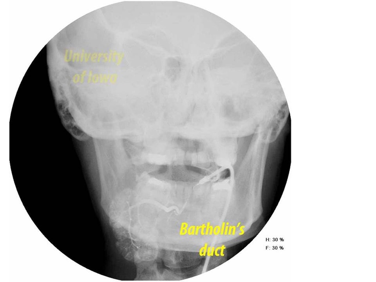 Slide17_3.JPG
