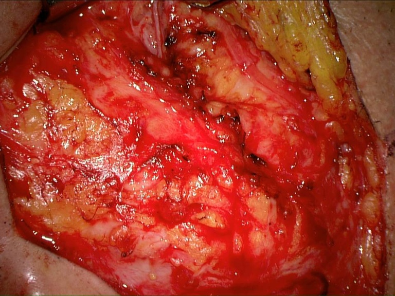 Slide17_4.JPG