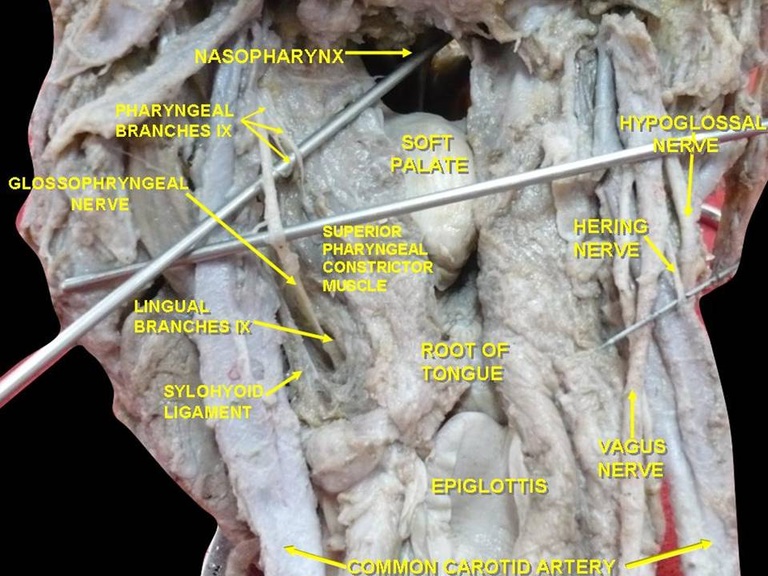 with permission from wikicommons  By Anatomist90 - Own work, CC BY-SA 3.0, https://commons.wikimedia.org/w/index.php?curid=23581018
