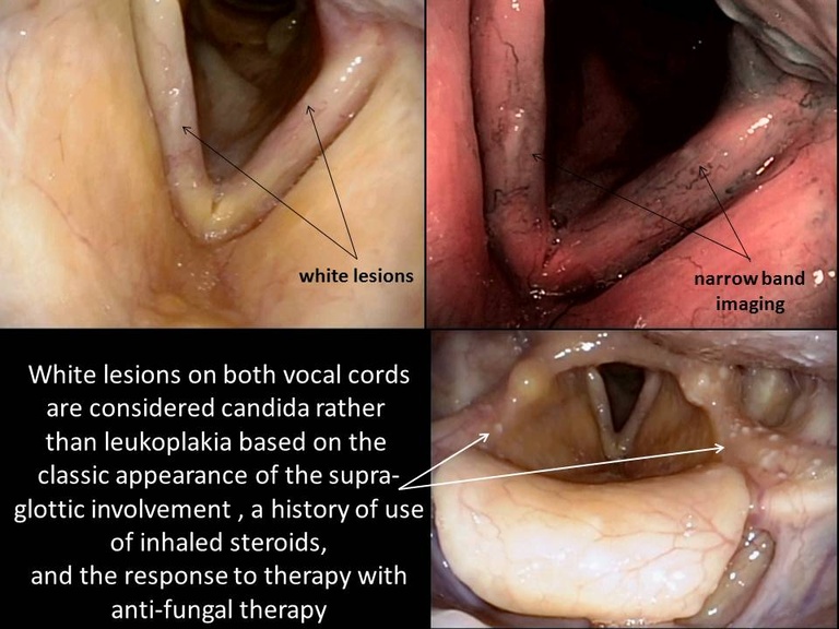 Slide1_14.JPG