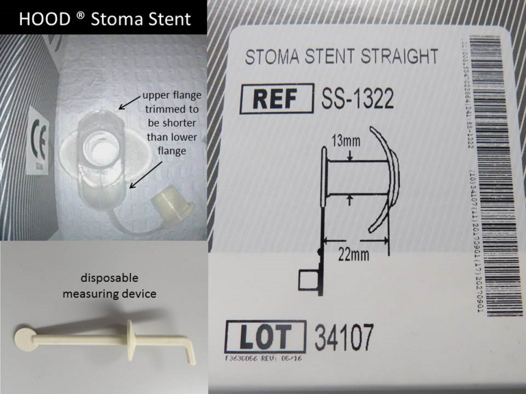Silicone Tracheostomal Vent