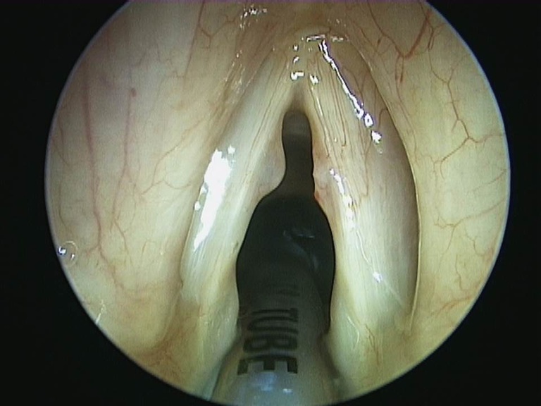 Slide1_23.JPG