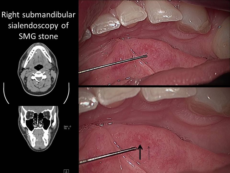 Slide1_33.JPG