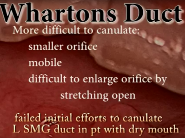 Slide1_43.PNG