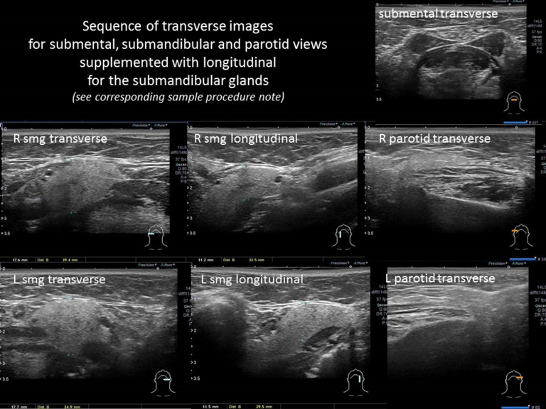 Sequence of images submental, submandibular and parotid views